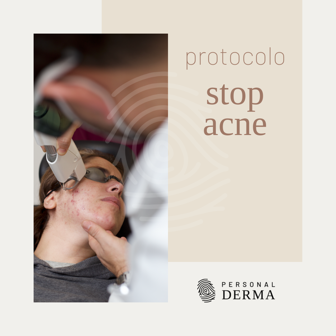 protocolo stop acne